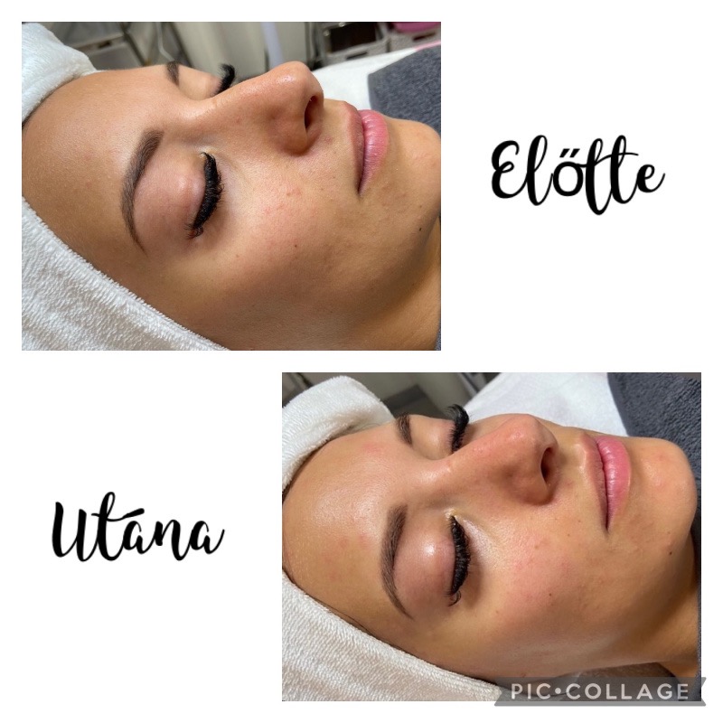Crystal Beauty Szeged referencia